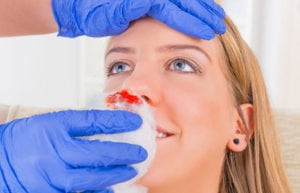 Nurse-Helping-Patient-with-Nosebleed