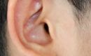 Ear-Reduction-LA-ENT-Doctor