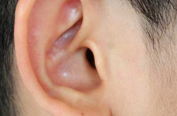 Ear-Reduction-LA-ENT-Doctor