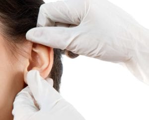 doctor-evaluating-patient-for-ear-enlargement-LA-ENT-Doctor